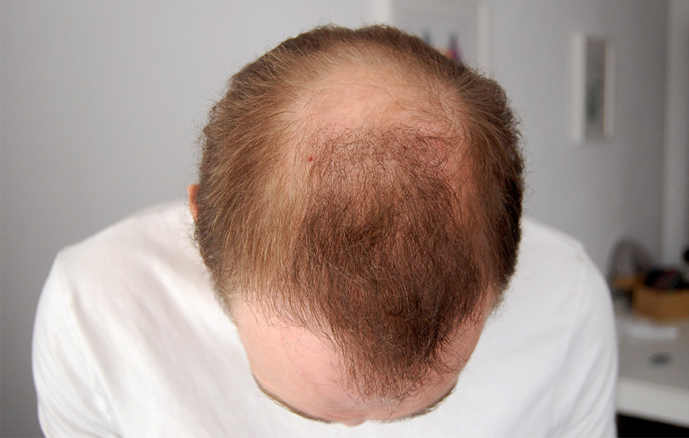 2022 06 17 (15) cropped